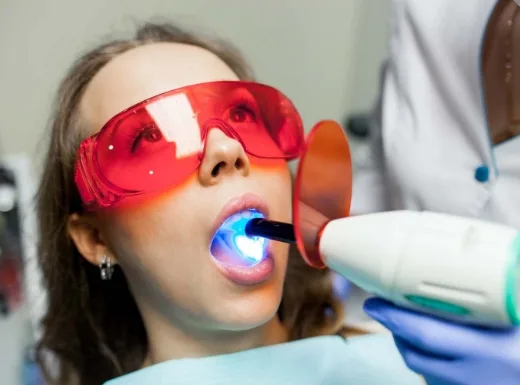 Borelli Implantes - Aplicação de Flúor