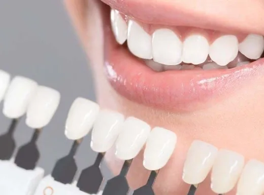 Borelli Implantes - Lentes Dentárias
