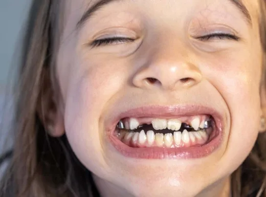Borelli Implantes - Odontopediatria