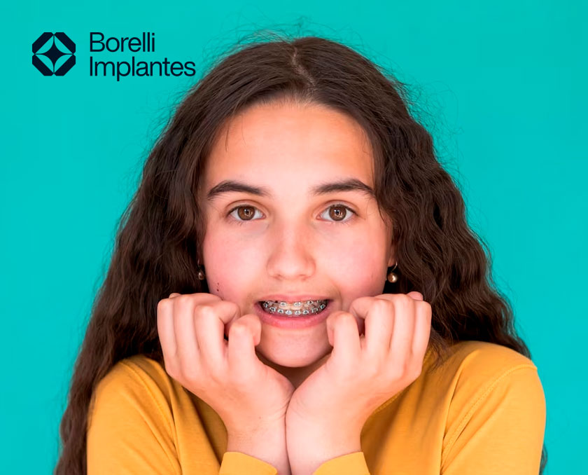 Borelli-Implantes--medo-de-colocar-aparelho-ortodôntico.