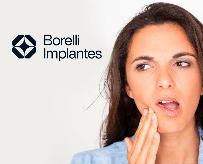 Borelli-Implantes-perdi-meu-dente-dicas